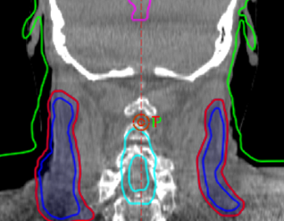 Clinical image